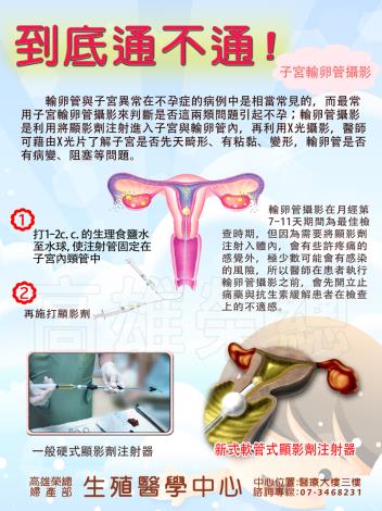 輸卵管攝影