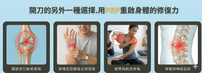 PRP自體血小板增生治療-不開刀的另外一種選擇