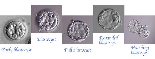 囊胚胚胎的發育過程